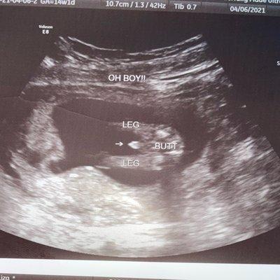 Our ultra sound! Clear as day! Haha