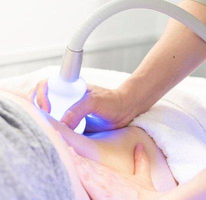 Cryoskin Slimming, Toning & Facials