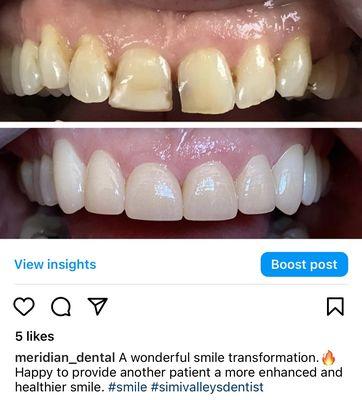 Cosmetic dentistry