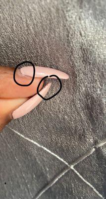 Uneven nail color