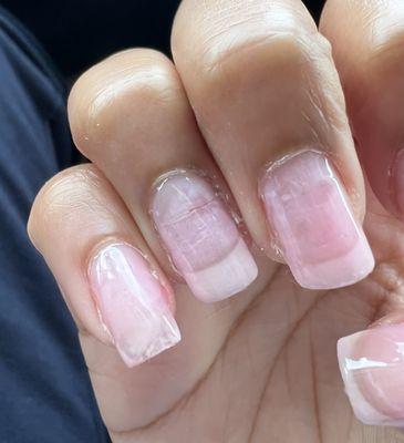 Princess Nails, how they removed the acrylic without soaking them, used a tool and peeled them off, cracking one nail right in the middle