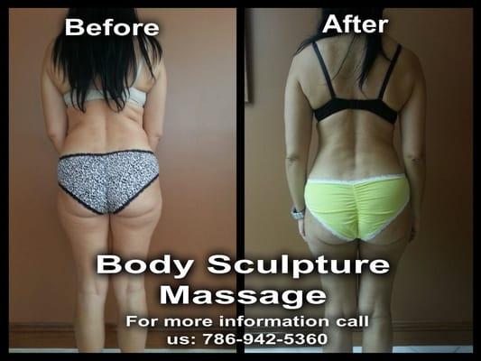 Body Shaping massage is a combination of manual massage and ultracavitation! Reduction can range from 2-4 cms. per session.