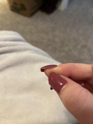 side of nail missing polish