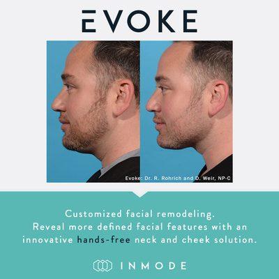 We offer the new EVOKE system by InMode, which is a non-surgical face remodeling solution. No downtime and no pain!