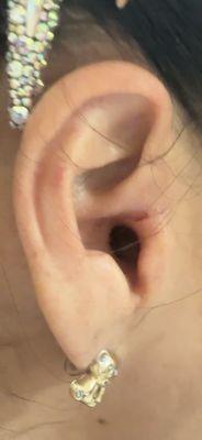 The old man on March 11 at 12:30 at I was punched me on my right side ear.see the cut inside my ear. I cannot hear.