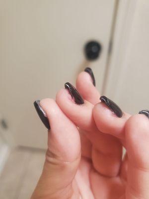 The cut where they drew blood from and tried to blame the fact that I asked for short nails and thats why I got cut.