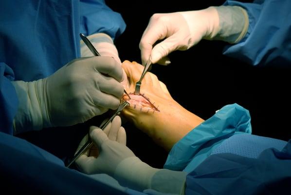 Bunion Surgery