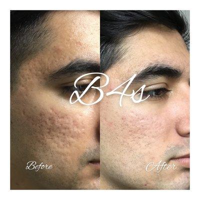 Beauti4Skin Medspa & Laser