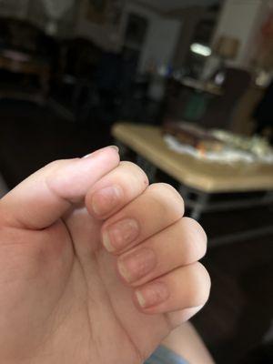 You can see the cracks in my nails