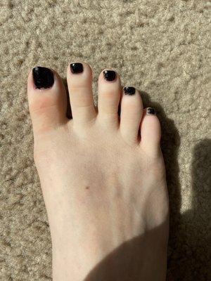 Messed up pedicure