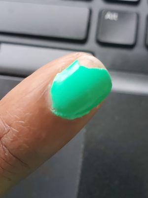 Chipped nail.