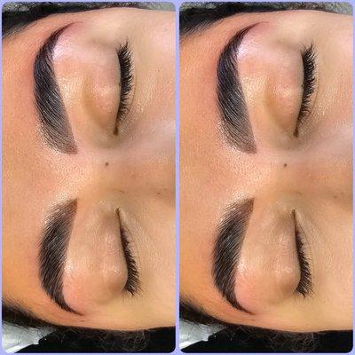 Our brow lamination