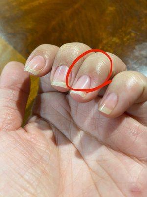 My cut cuticle circled in red