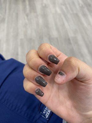 broken gel acrylic 2 days post refill