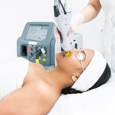 Women's Laser Hair Removal for the upper lip. Takes less than 2 minutes!