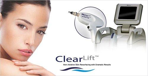 Alma Laser's ClearLift™ improves fine lines, wrinkles, the appearance of small veins and redness caused by vascularity. No downtime!