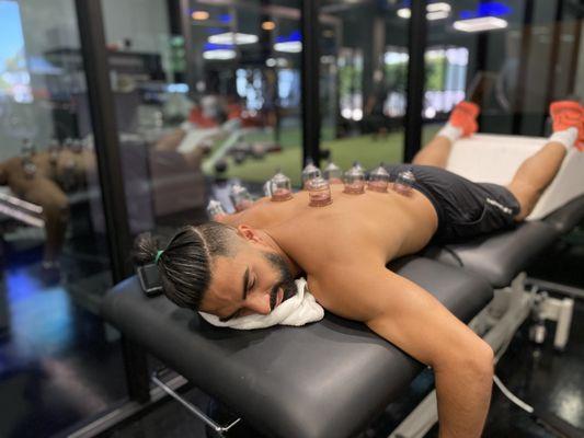 One of our loyal patients getting cupped after an intense  workout.