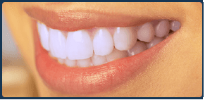 Teeth Whitening | Jacksonville, St. Augustine FL