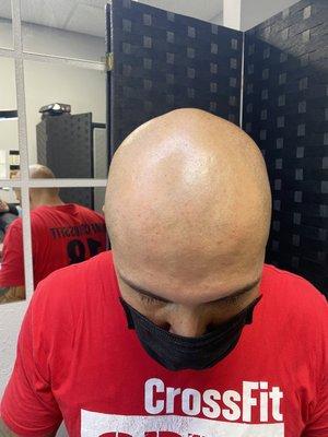 before first scalp micropigmentation session