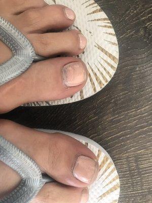 Results of my pedicure a week later having paid extra for their long lasting polish !