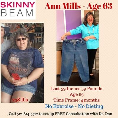 Ann lost 59 Pounds in 4 Months at age 63 on Dr. Don Fat Loss Metabolic Program and Skinny Beam