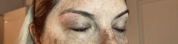 Brow shaping