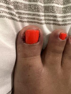 Worst pedicure of my life