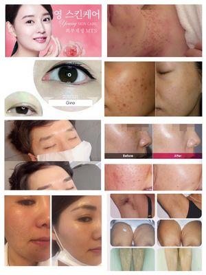 Young skin care 7183580930