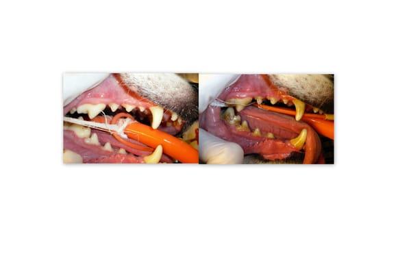 Check out the difference a teeth cleaning can make!