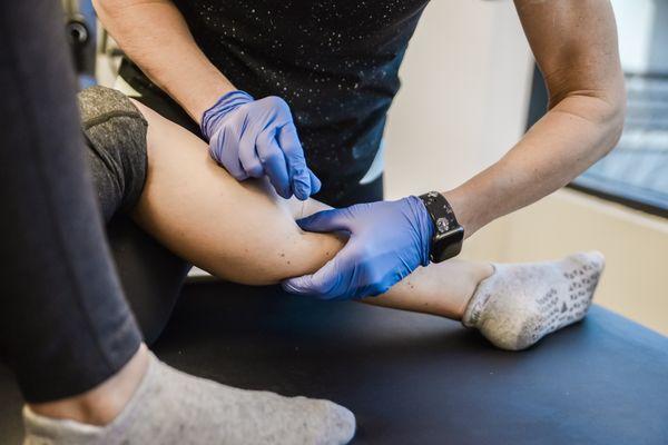 Our practitioners use Trigger Point Dry Needling to decrease muscular pain and stiffness, and improve flexibility and range of motion.