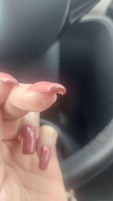 Repaired nail ridiculously thick