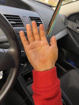 Here's a lovely picture of what happened to your hands when you spray at zoom tan! Only your hands get tan :)