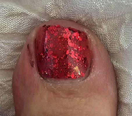 Cut toe from pedicure