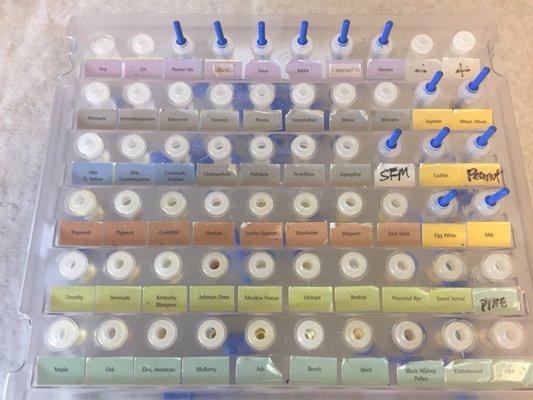 Allergens for allergy test