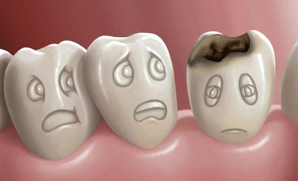 Don't be afraid of a cavity.Proven Dental can take care of it so noone will ever know you have a filling.