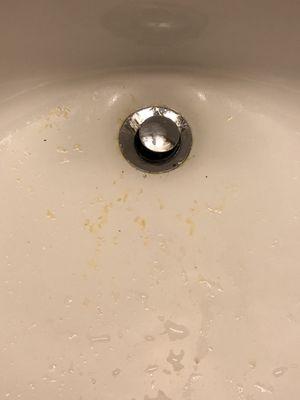 Vomit in the sink