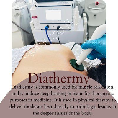 #diathermy #diatermia