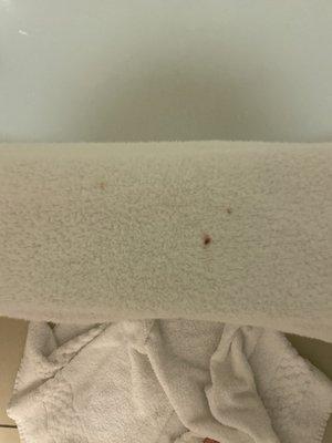 Towel had blood stains