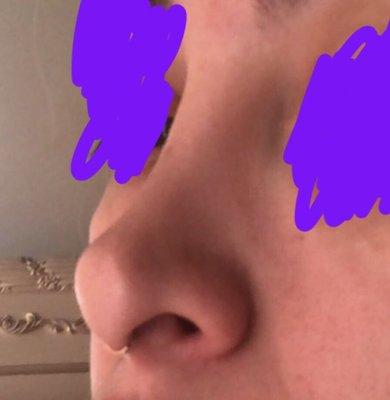 The tip of my nose is flat, the nostrils are different shapes