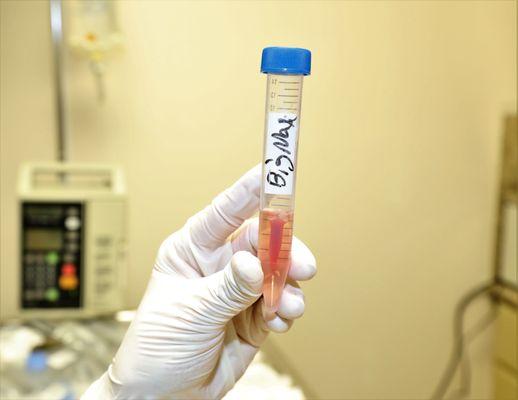 By enzymatic reaction the platelet membrane is broken, forming a gel matrix and releasing the growth factors to the medium