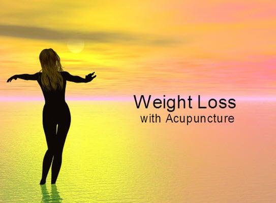 Acupuncture help to loss weight.