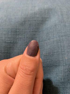 Bumpy and dented nail