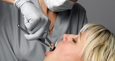 Tooth Extraction