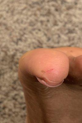 Discover another small cut on my toe after leaving the nail shop. 2 small cuts in one visit. Accident I know, but still