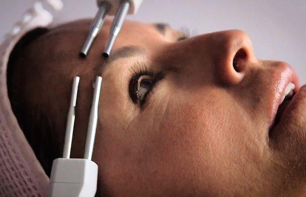 Microcurrent improves muscle tone in the face and neck, lifting jowls and eyebrows. It reduces fine lines and enhances product penetration.