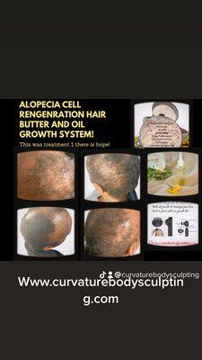 Hair growth with natural healing