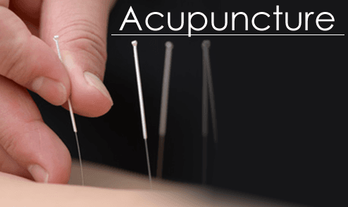 Acupuncture For Life