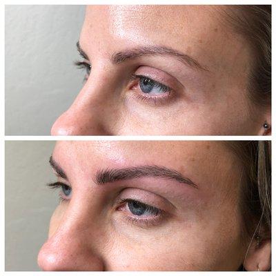 Microblading