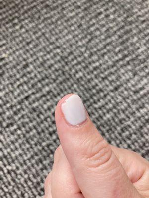 Edge of nail bubbled and peeled