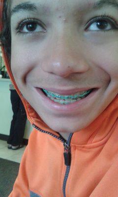 Beautiful smile! proud of his Aqua bands.